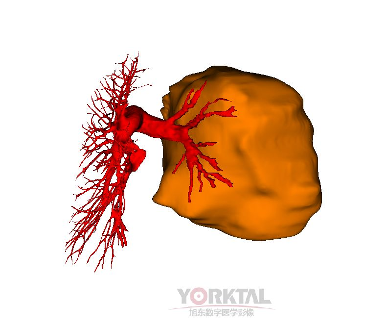 723AE86B-E6A7-48dd-AD41-F4D3ABEB0865.png