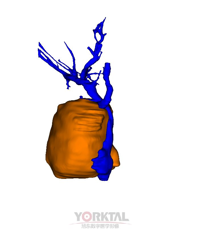F91B6F5C-ED4C-4fb4-9C6D-94C685E619F6.png