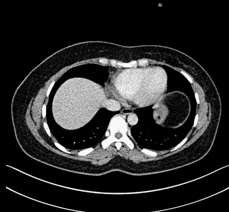 CT GIF.gif