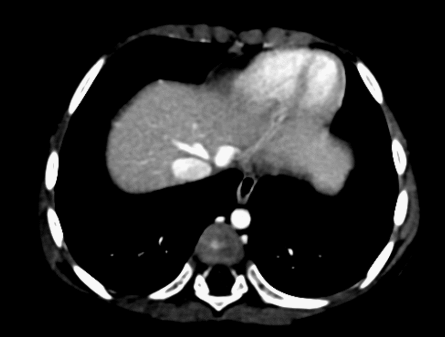 CT GIF.gif