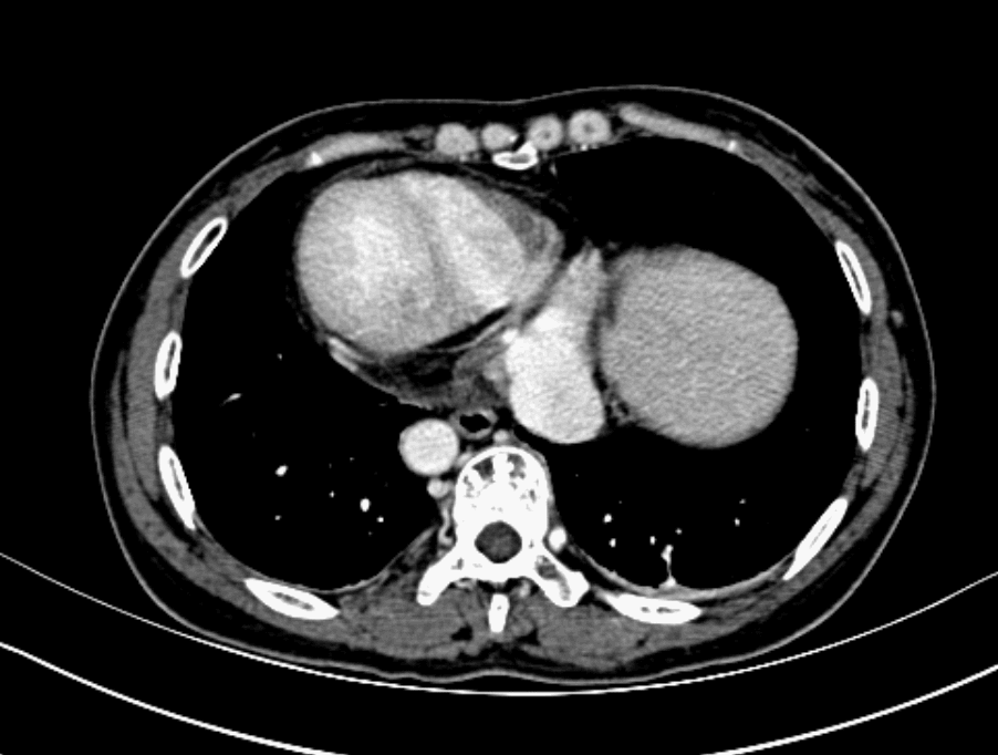 CT GIF.gif